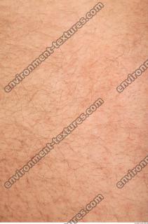 human skin hairy 0022